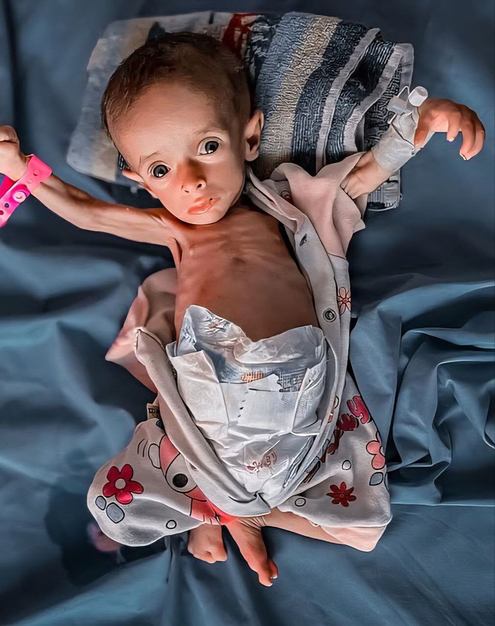 Gaza hospitals report new child deaths from famine