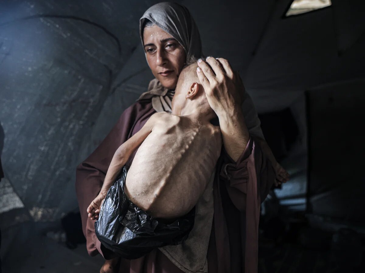 گرسنگی تاکنون جان چند فلسطینی را گرفته است؟