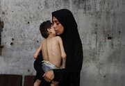 UN: All Gaza children under five at risk of life-threatening malnutrition