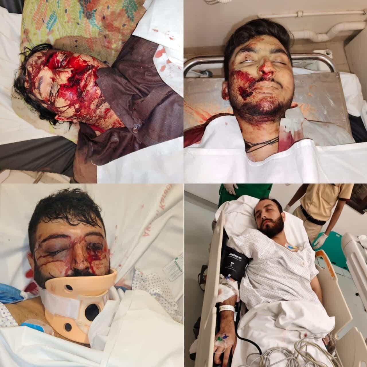 شهید و زخمی شدن ۵ شیعه پاکستانی در حمله گروه تکفیری سپاه صحابه