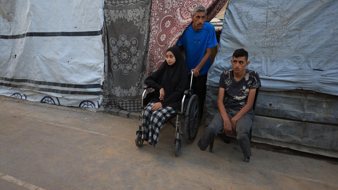 افزایش ۲۲۵ درصدی قطع عضو در جنگ غزه