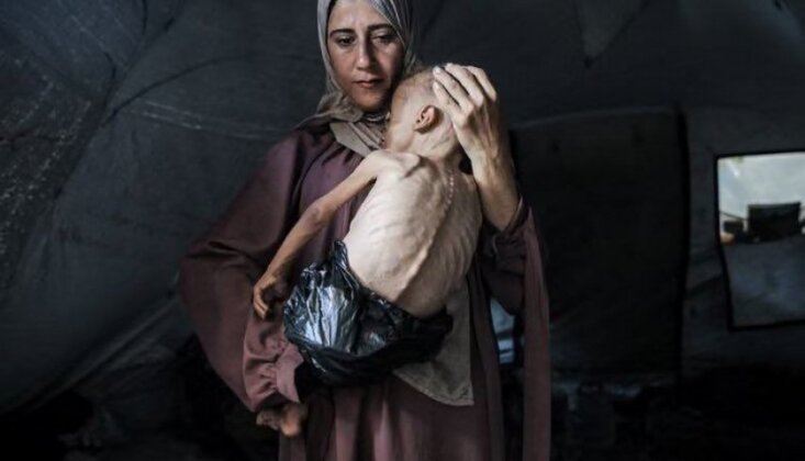 Gazze Açlıktan Ölüyor; Son 24 Saatte 4 Filistinli Daha Açlıktan Şehit Oldu