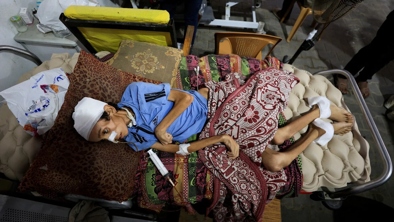 Eleven more Palestinians die of starvation in Gaza