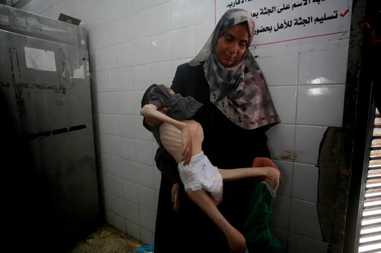 شمار قربانیان گرسنگی و سوءتغذیه در غزه به ۲۳۹ نفر رسید