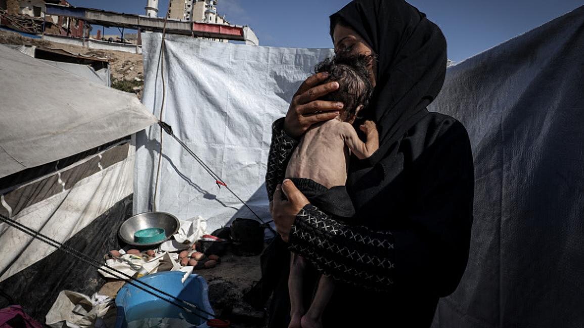 Five more people, including child, die of malnutrition in Gaza