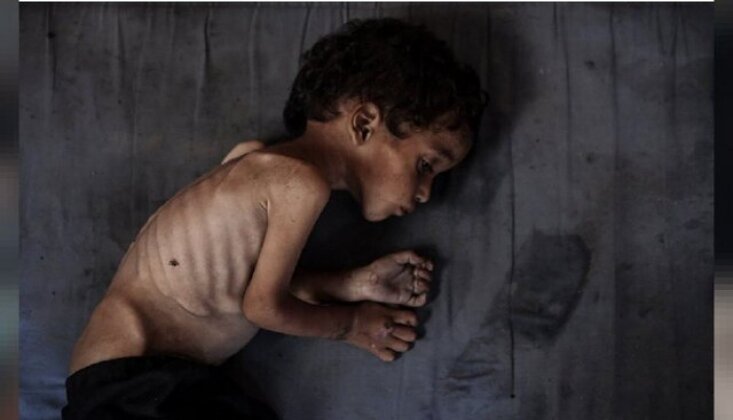 Gazze’de 24 Saatte 8 Kişi Daha Açlıktan Şehit Oldu