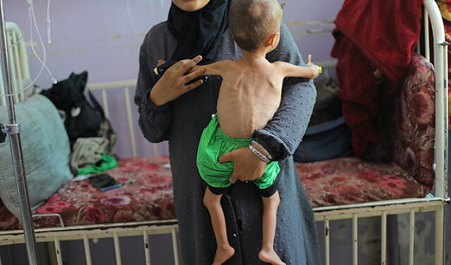 UNICEF warns of rising child malnutrition in Gaza; 112 children every day