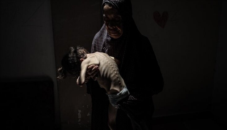 Gazze'de 11 Kişi Daha Açlıktan Şehit Oldu