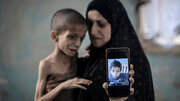 Gutom Bilang Kasangkapan ng Torture: Ulat ng Amnesty International sa Gaza