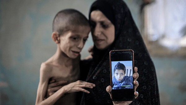Gutom Bilang Kasangkapan ng Torture: Ulat ng Amnesty International sa Gaza
