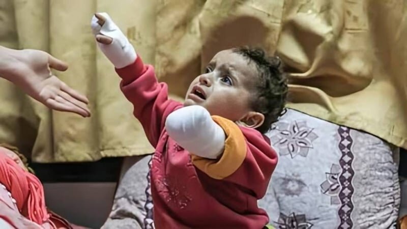 İsrail Rejiminin Saldırıları Nedeniyle Gazze'de Her Gün Kaç Kişi Engelli Hale Geliyor?