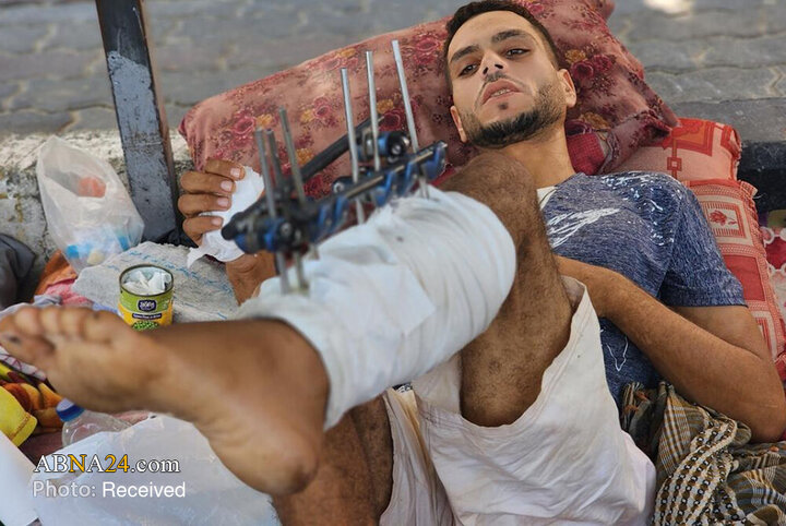 خدمت‌رسانی به مجروحان خان یونس در محوطه بیمارستان ناصر