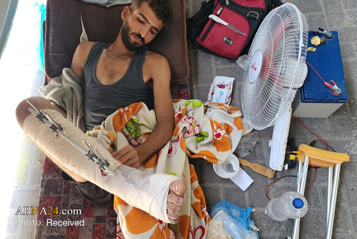 Foto / Nasır Hastanesinde Han Yunus Yaralılarına hizmet