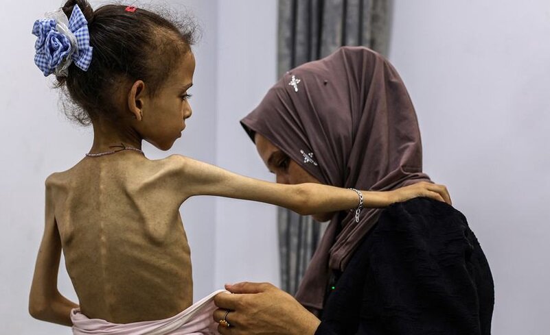 نیویارک: اقوام متحدہ نے بالآخر غزہ میں قحط کا اعلان کر دیا