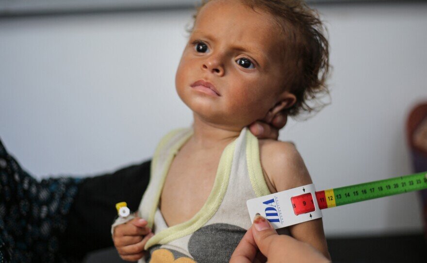 Oxfam: Famine in Gaza is a man-made catastrophe sriven by Israeli blockade