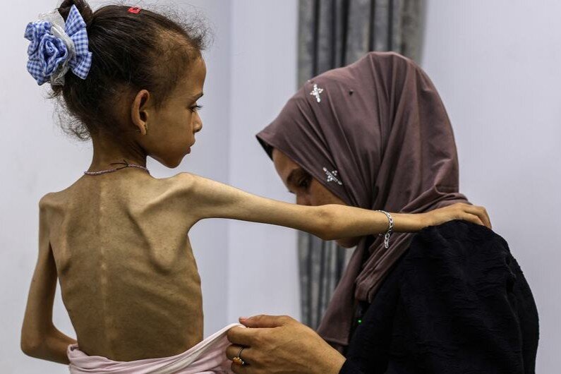 UN’s Ramiz Alakbarov warns famine in Gaza is man-made disaster