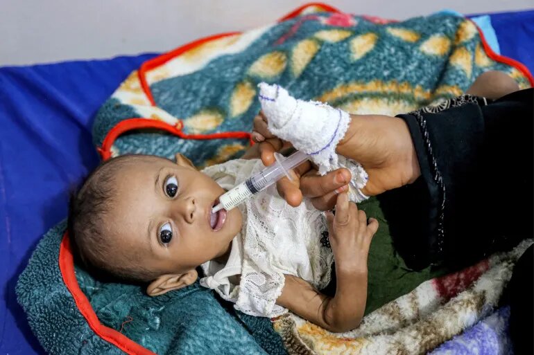 هشدار سازمان ملل: ۱۸ میلیون یمنی در آستانه گرسنگی شدید هستند