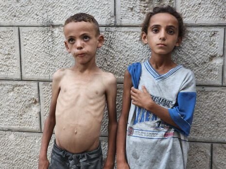 Gaza death toll from starvation climbs to 303, including 117 kids