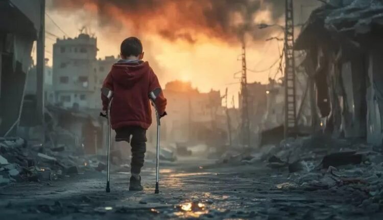 MSF: One-third of Gaza’s wounded are children under 15