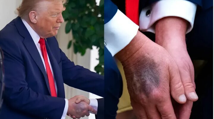 Adakah Donald Trump Sudah Mati?