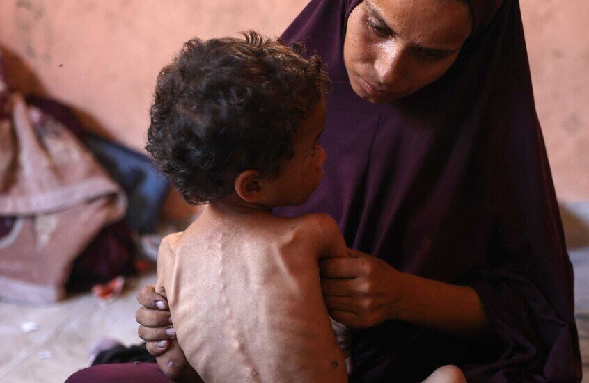 وباء جديد يضرب غزة: فيروس قاتل يشبه كورونا يفتك بالأطفال الجوعى