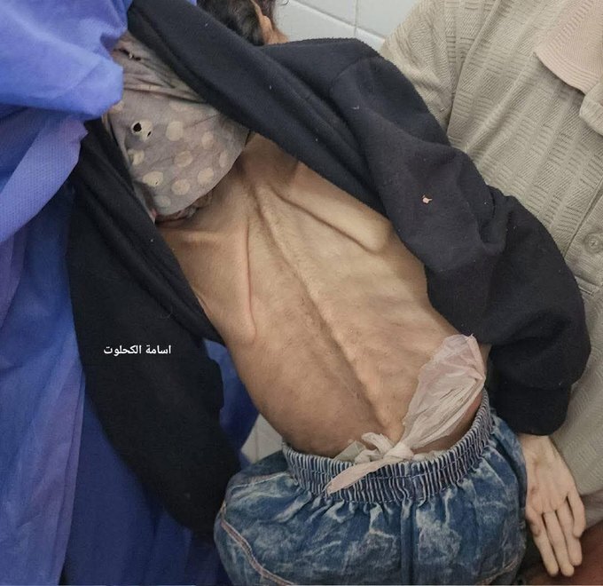 UN warns of imminent famine in Gaza as humanitarian window closes