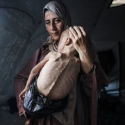 Gazze Açlıktan Ölüyor; 422 Şehit