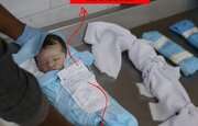 图片报道 | 加沙婴儿因封锁及药物食物短缺而死亡