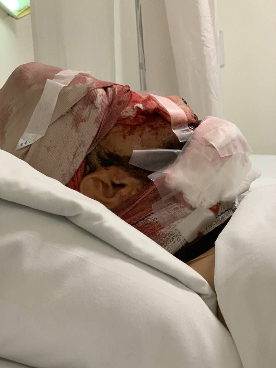 همسر جانباز لبنانی؛ همسرم برای چهارمین مدال جانبازی گرفت/ با تمام جراحات در راه مقاومت میمانیم+ ویدیو