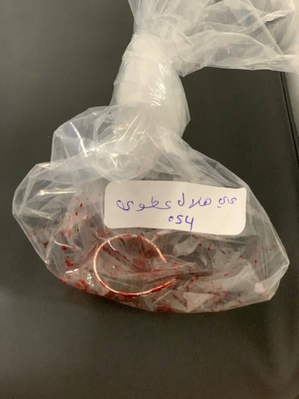 همسر جانباز لبنانی؛ همسرم برای چهارمین مدال جانبازی گرفت/ با تمام جراحات در راه مقاومت می‌مانیم+ ویدیو