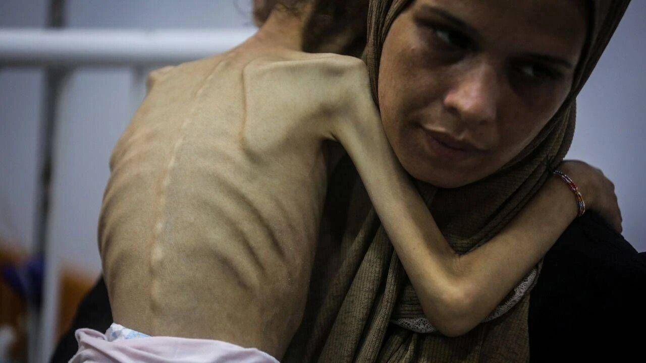 Vifo vya Wapalestina 453, wakiwemo watoto 150, vimeripotiwa kutokana na njaa na utapiamlo huko Gaza