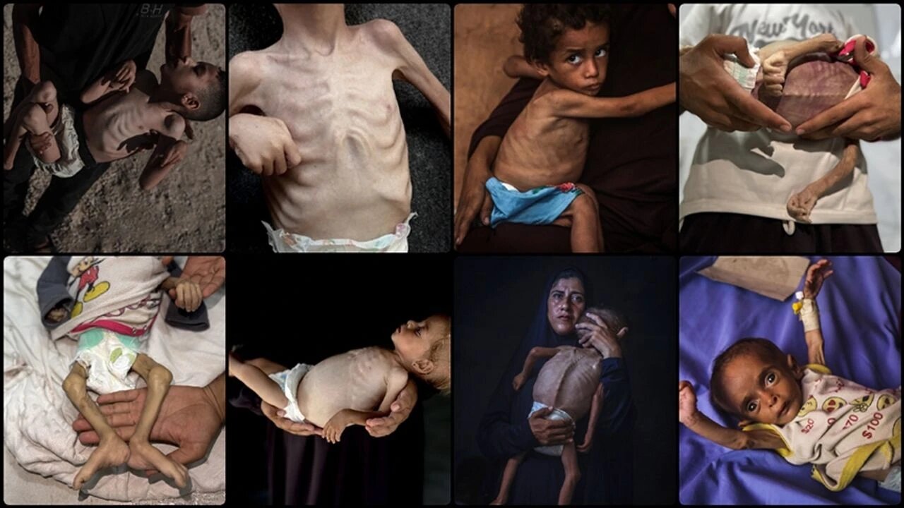 Siyonist İsrail kuşatması can almaya devam ediyor: Açlıktan 455 şehit