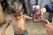 Janga la Kibinadamu Gaza; Watoto Yatima Katika Hali ya Ndoto Mbaya