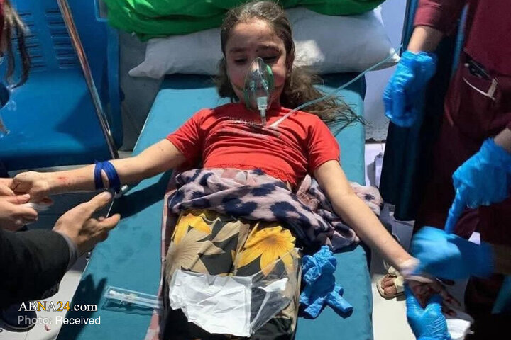 عکس خبری | کودکان زخمی از حملات هوایی پاکستان به کابل