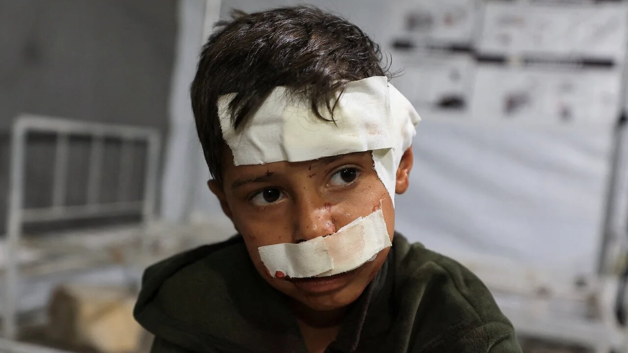 Gaza Patients Dying as Medical Supplies Remain Low, Hospital Chief Warns