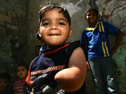 Analysis / Gaza Disability Crisis: A Non-healing Wound