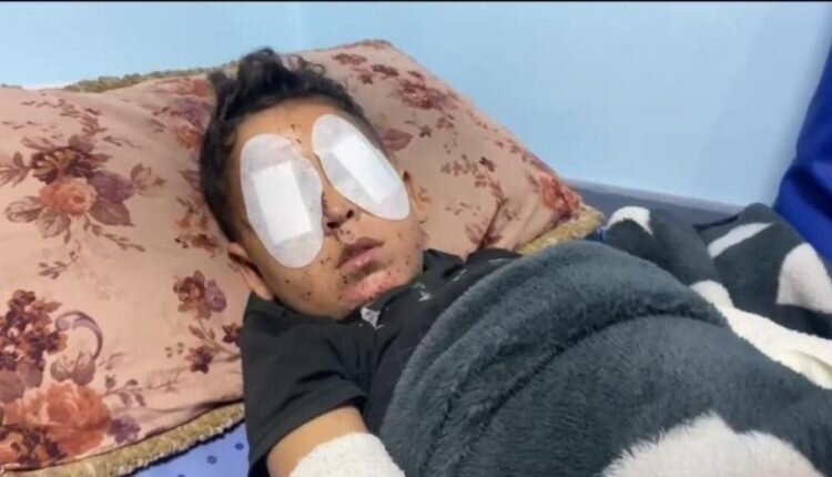 Gaza Health Ministry warns of collapse in eye care services