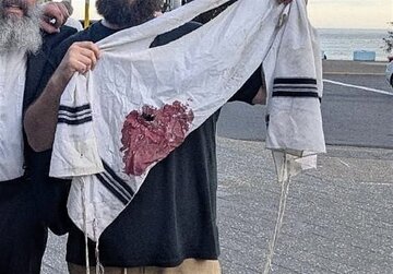 သြစတြေးလျတွင် ဟာနုကာပွဲတော်အတွင်း ဇီယွန်ဝါဒီ အနည်းဆုံး ၁၀ ဦး သေဆုံး