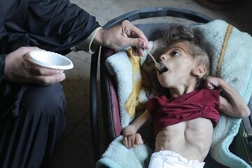 WHO Warns Gaza Faces Surging Famine Risk