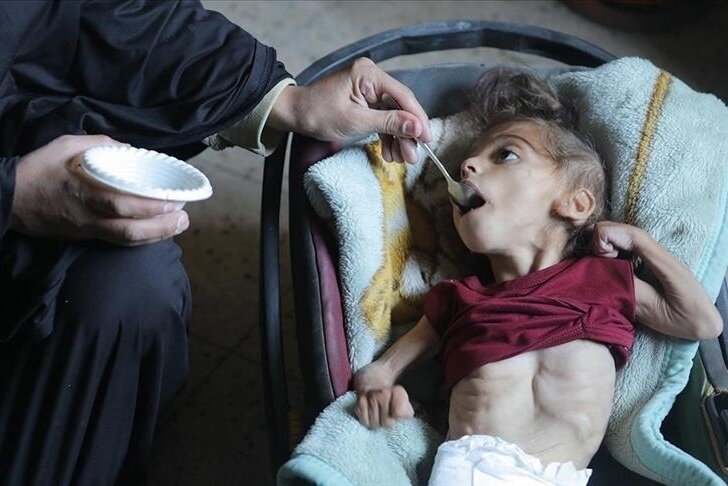 WHO Warns Gaza Faces Surging Famine Risk