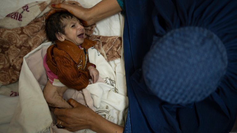 یونیسف: ۸۵۷هزار کودک دچار سوءتغذیه در افغانستان نیاز فوری به درمان دارند