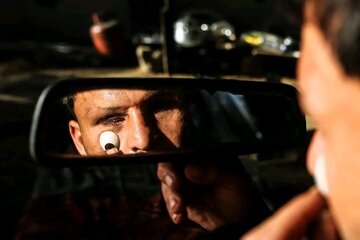 تماشای امید؛ روایت جوانی که در حملات اسرائیل بینایی‌اش را از دست داد + تصاویر