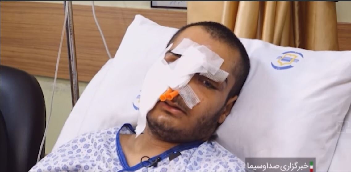 ویدیو | روایت »طاها موسوی« از لحظه اصابت نارنجک به صورتش