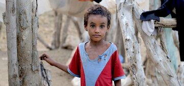 Blockade deprives 20 million Yemenis of healthcare, threatens lives of 400,000 children
