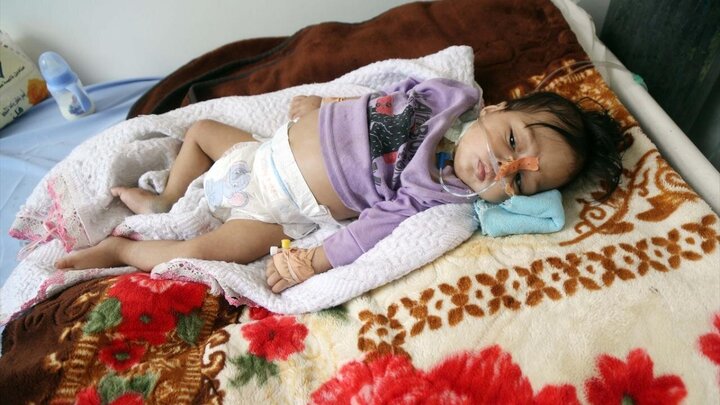 Raporê wêneyî / Milyonan zarokên Yemenî bi kêmbûna xwarinê (Sûxwarinê) re têkoşîn dikin