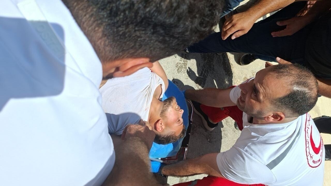 Seven Palestinians Injured in Settler Attack on Far’ata Amid West Bank Escalation