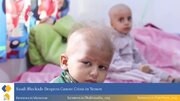 Yemeni Officials Warn Cancer Patients Facing Fatal Delays Under 11‑Year Saudi‑Led Blockade