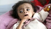 22 miliona ljudi u Jemenu treba humanitarnu pomoć