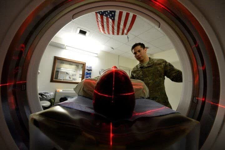 Associated Press: Daan-daang sundalong Amerikano ang nasugatan, karamihan sa kanila ay traumatic brain injury