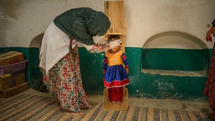سوءتغذیه حاد، جان کودکان افغانستان را تهدید میکند